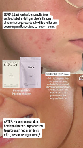 1 WOCHE: Hautstrahlungs-Paket